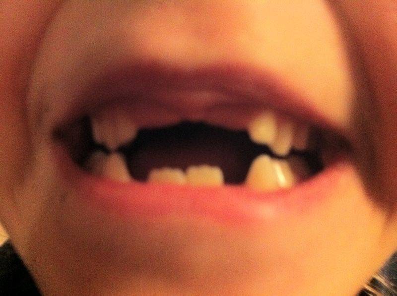 Moet Jeske niet een tandje bijzetten?